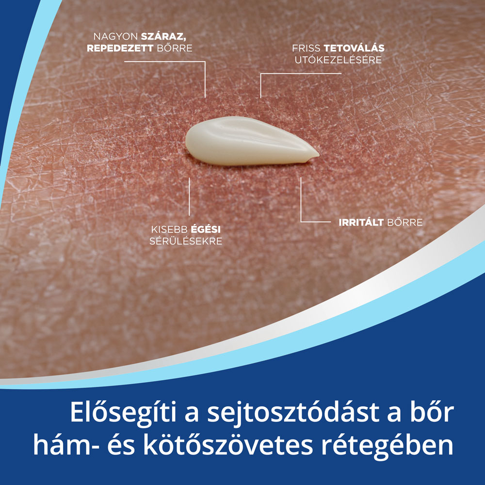Bepanthen kenőcs